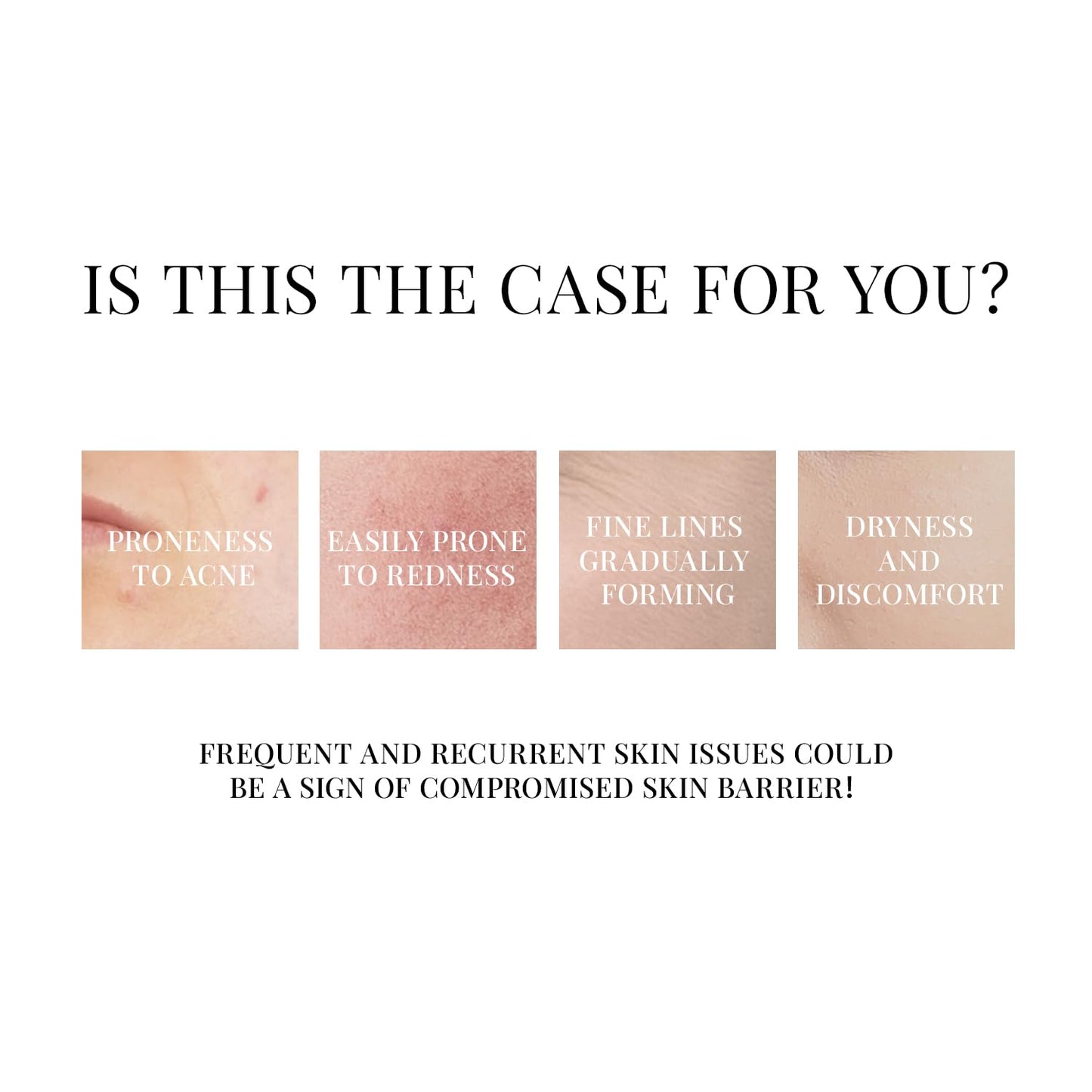 +WIS+ Hyaluronic Acid Face Mask 24 EA with Hyaluronic Acid Serum and Vitamin B5, Hydrating Facial Mask for Dry Skin, Anti-Aging Mask to Plump and Repair Dehydrated Skin, Safe on Sensitive Skin